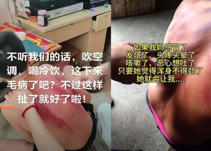 警惕 “宝妈自学中医” 乱象：传统医学在荒诞实践中被扭曲插图7