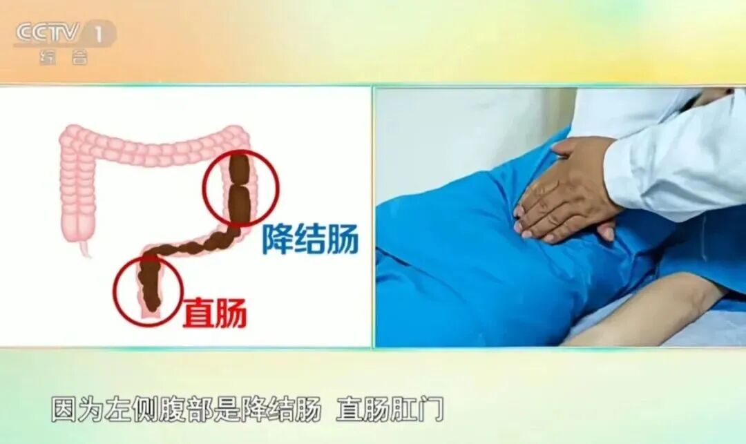 望京医院专家支招：5 个中医手法，告别便秘困扰插图1
